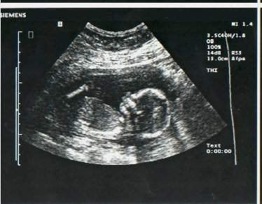 babydonk.jpg